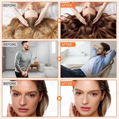 Pumpkin Seed Oil & Saw Palmetto Softgels | Reson